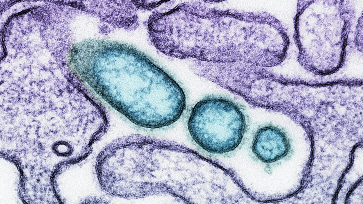 ¿Qué está pasando con el virus Nipah y por qué no hay motivo de alarma en España?